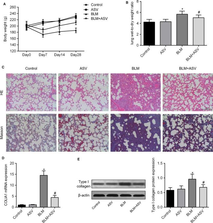 https://cdn.ncbi.nlm.nih.gov/pmc/blobs/8fd2/6111865/c82a10abd661/JCMM-22-4354-g001.jpg
