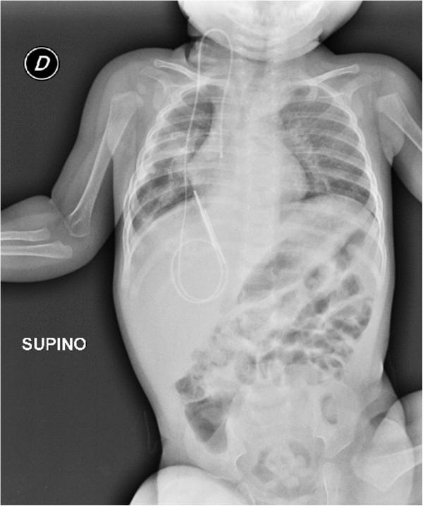 https://cdn.ncbi.nlm.nih.gov/pmc/blobs/8fd3/4131777/71c018642e6b/1752-1947-8-221-2.jpg