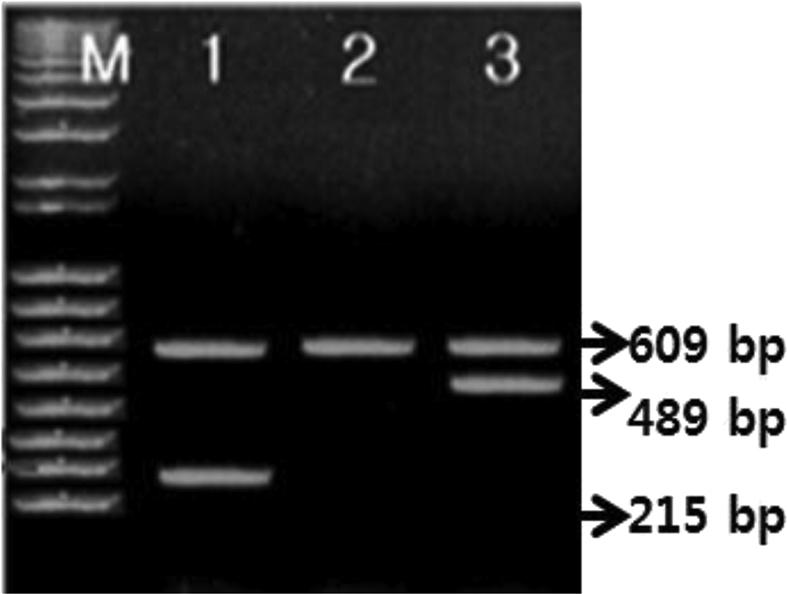 https://cdn.ncbi.nlm.nih.gov/pmc/blobs/8fd5/5052432/87ffc57081ba/gr4.jpg
