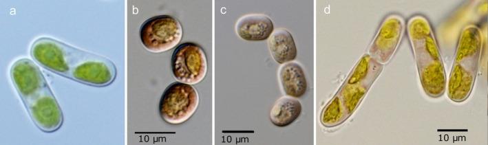 https://cdn.ncbi.nlm.nih.gov/pmc/blobs/8feb/12257149/8130bb92a94e/EMI4-17-e70149-g004.jpg