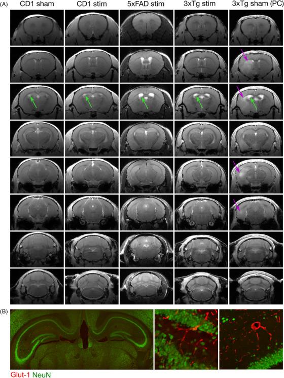 https://cdn.ncbi.nlm.nih.gov/pmc/blobs/8ff1/11848200/c383abda644d/ALZ-21-e14511-g003.jpg
