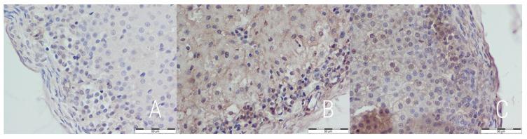 https://cdn.ncbi.nlm.nih.gov/pmc/blobs/8ffe/6262569/f6751a28b206/medicina-54-00090-g005.jpg