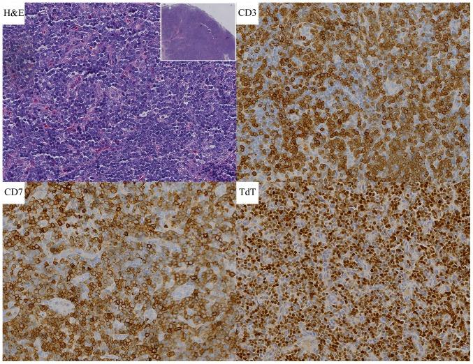 https://cdn.ncbi.nlm.nih.gov/pmc/blobs/9001/6202486/4687e7646b7e/ol-16-05-6624-g00.jpg