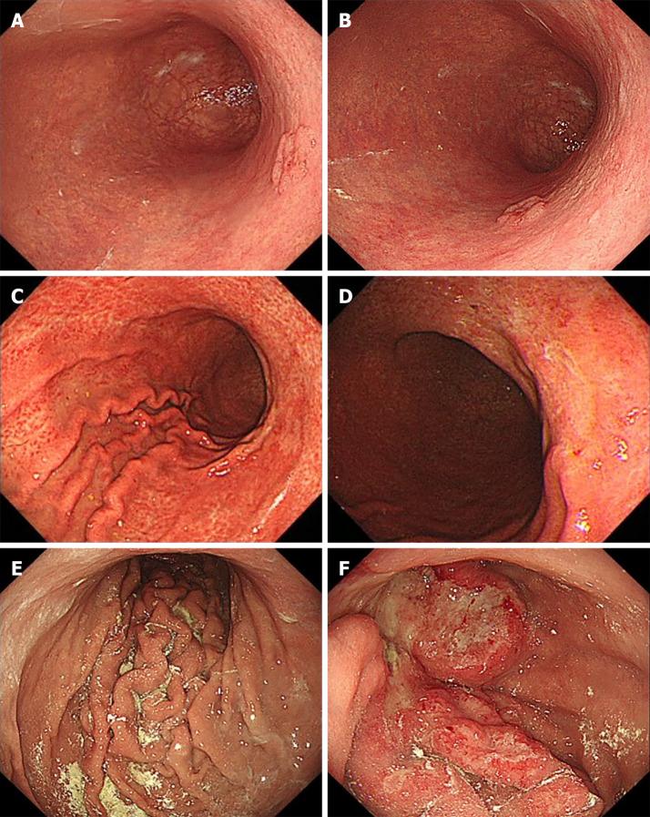 https://cdn.ncbi.nlm.nih.gov/pmc/blobs/900a/8474696/39790dfc474d/WJGE-13-426-g003.jpg