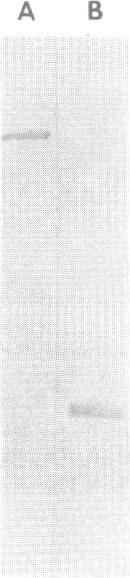 https://cdn.ncbi.nlm.nih.gov/pmc/blobs/900b/306299/00d9f562ab05/nar00263-0020-a.jpg