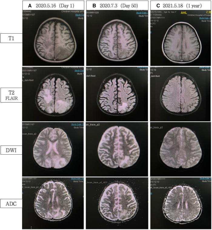 https://cdn.ncbi.nlm.nih.gov/pmc/blobs/900e/11169638/ddb8f2310fd6/fped-12-1409950-g002.jpg