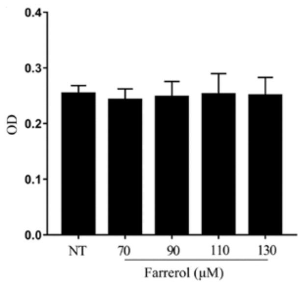 https://cdn.ncbi.nlm.nih.gov/pmc/blobs/900e/6032361/ad4ae4c6c5ef/ijms-19-01770-g007.jpg