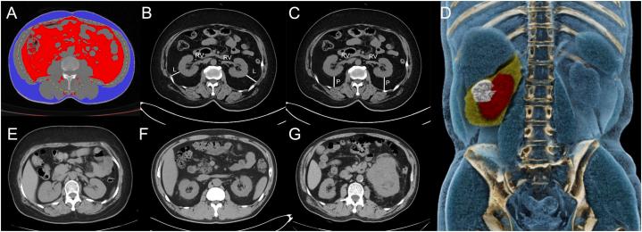 https://cdn.ncbi.nlm.nih.gov/pmc/blobs/900f/10803934/aff4d4972357/gr2.jpg