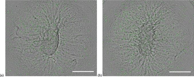 https://cdn.ncbi.nlm.nih.gov/pmc/blobs/9021/12283541/10c592058b93/44164_2024_80_Fig7_HTML.jpg