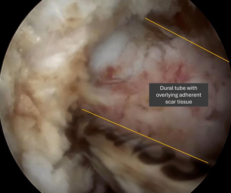 https://cdn.ncbi.nlm.nih.gov/pmc/blobs/9029/12306511/472bf379544b/cureus-0017-00000086958-i08.jpg