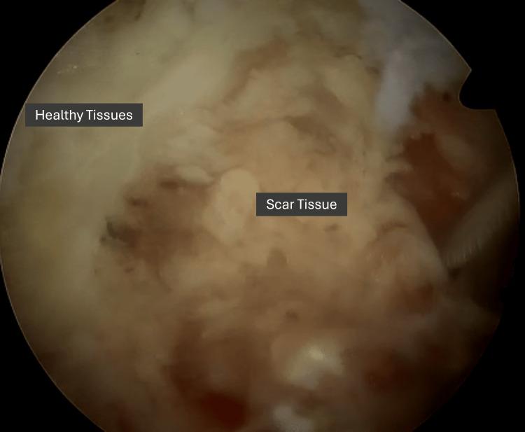 https://cdn.ncbi.nlm.nih.gov/pmc/blobs/9029/12306511/68c06be3eaf3/cureus-0017-00000086958-i04.jpg