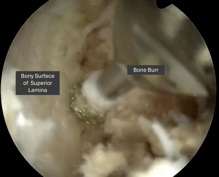https://cdn.ncbi.nlm.nih.gov/pmc/blobs/9029/12306511/935dc5f4212f/cureus-0017-00000086958-i02.jpg