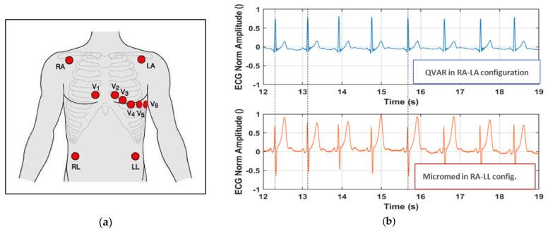 https://cdn.ncbi.nlm.nih.gov/pmc/blobs/9034/10934124/7d65f20822bb/sensors-24-01554-g002.jpg