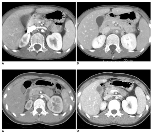 https://cdn.ncbi.nlm.nih.gov/pmc/blobs/9037/2627167/3a71b1bfc3c0/kjr-8-286-g002.jpg