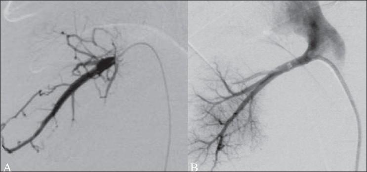 https://cdn.ncbi.nlm.nih.gov/pmc/blobs/903a/2747437/6d593feee974/IJRI-18-249-g005.jpg