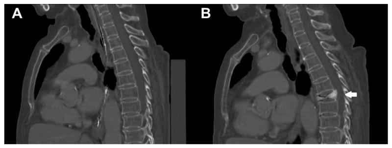 https://cdn.ncbi.nlm.nih.gov/pmc/blobs/903e/7998199/f9900c2f3dc4/diagnostics-11-00455-g002.jpg