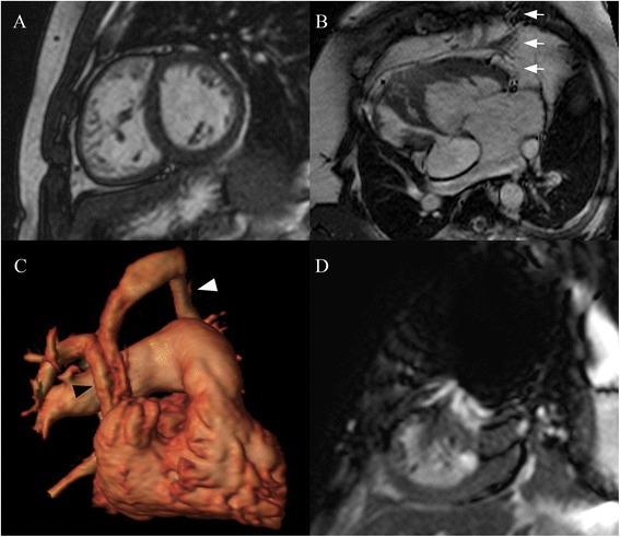 https://cdn.ncbi.nlm.nih.gov/pmc/blobs/9040/4490663/d9cd2cd569e2/12968_2015_144_Fig1_HTML.jpg