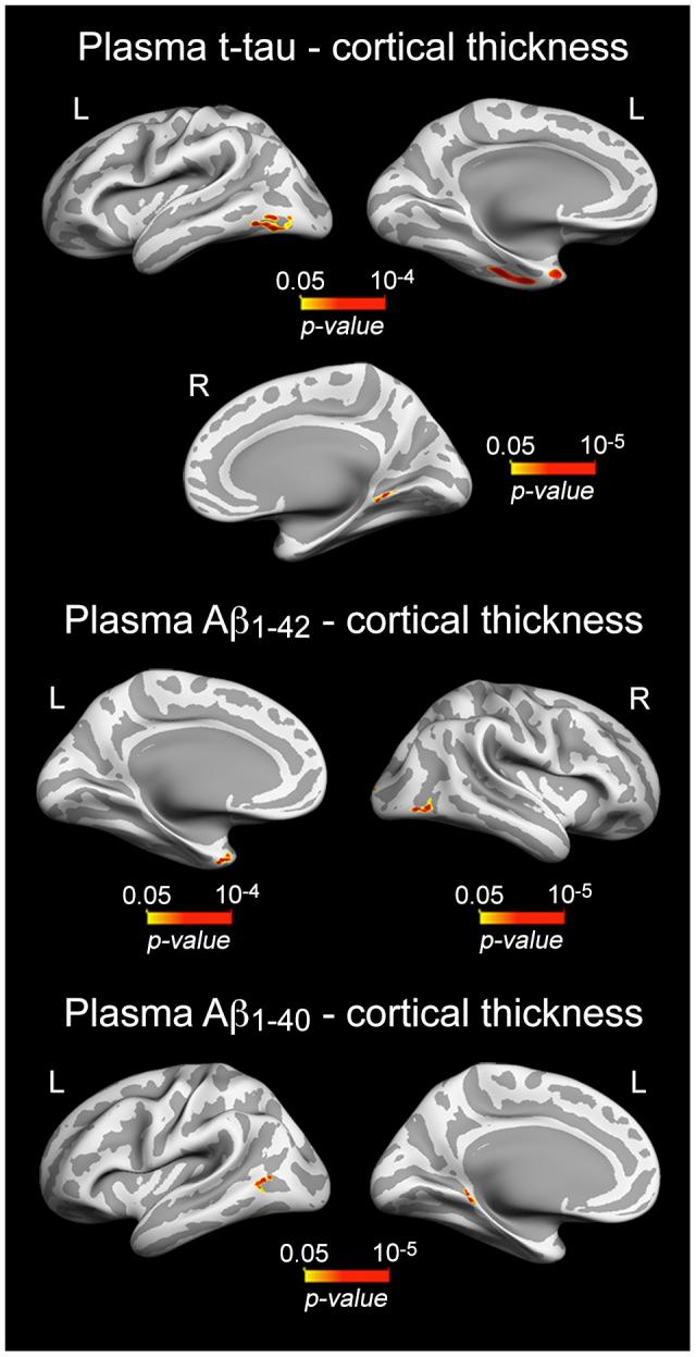 https://cdn.ncbi.nlm.nih.gov/pmc/blobs/9042/7695405/03a26cae433d/aging-12-104057-g003.jpg