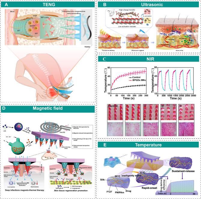 https://cdn.ncbi.nlm.nih.gov/pmc/blobs/9044/12048949/016b413e2943/12951_2025_3383_Fig4_HTML.jpg