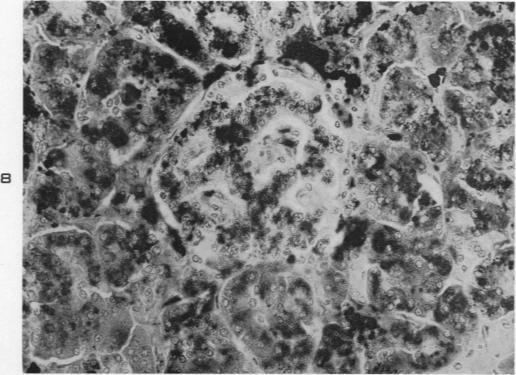 https://cdn.ncbi.nlm.nih.gov/pmc/blobs/9048/1942465/80a829ad1d48/amjpathol00702-0112-b.jpg