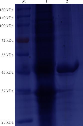 https://cdn.ncbi.nlm.nih.gov/pmc/blobs/904d/10807947/a3cdbd844049/JIR2024-8816919.001.jpg