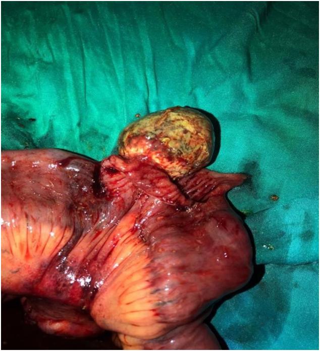 https://cdn.ncbi.nlm.nih.gov/pmc/blobs/9057/8935495/4834a0db7999/gr3.jpg
