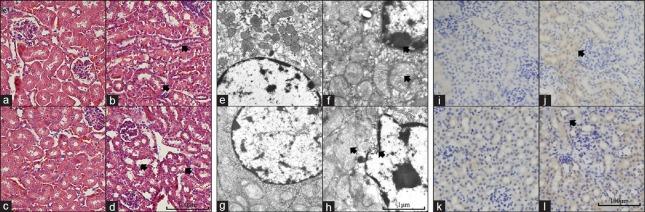 https://cdn.ncbi.nlm.nih.gov/pmc/blobs/9058/4852679/f0353c368055/CMJ-129-1100-g002.jpg