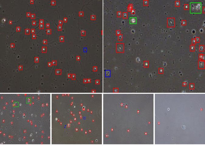 https://cdn.ncbi.nlm.nih.gov/pmc/blobs/9065/10167330/f01c437495dd/41597_2023_2173_Fig1_HTML.jpg