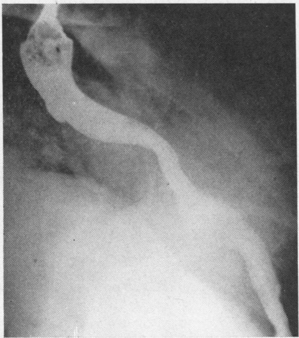 https://cdn.ncbi.nlm.nih.gov/pmc/blobs/9065/471918/355b48934ddc/thorax00103-0041-a.jpg