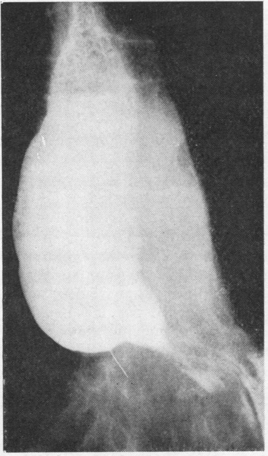 https://cdn.ncbi.nlm.nih.gov/pmc/blobs/9065/471918/929427adb18c/thorax00103-0037-a.jpg