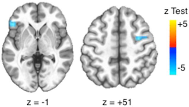 https://cdn.ncbi.nlm.nih.gov/pmc/blobs/9066/5675888/57c42a4d6b60/fnbeh-11-00205-g0004.jpg