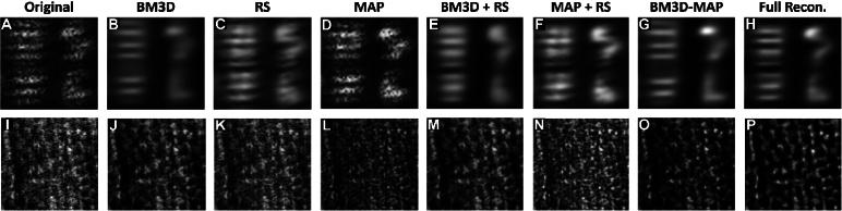 https://cdn.ncbi.nlm.nih.gov/pmc/blobs/9070/11407272/fa1fe52e314e/boe-15-9-5491-g005.jpg