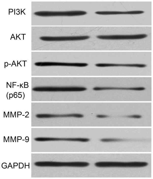 https://cdn.ncbi.nlm.nih.gov/pmc/blobs/9079/4186632/73c285b5e037/OL-08-05-2063-g03.jpg