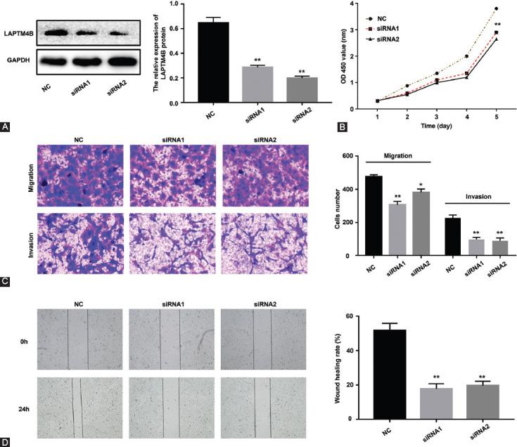 https://cdn.ncbi.nlm.nih.gov/pmc/blobs/9079/8112566/e422e75f9abb/BJBMS-21-305-g006.jpg