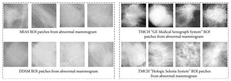 https://cdn.ncbi.nlm.nih.gov/pmc/blobs/907b/6178513/e2e311906c23/JHE2018-5940436.005.jpg