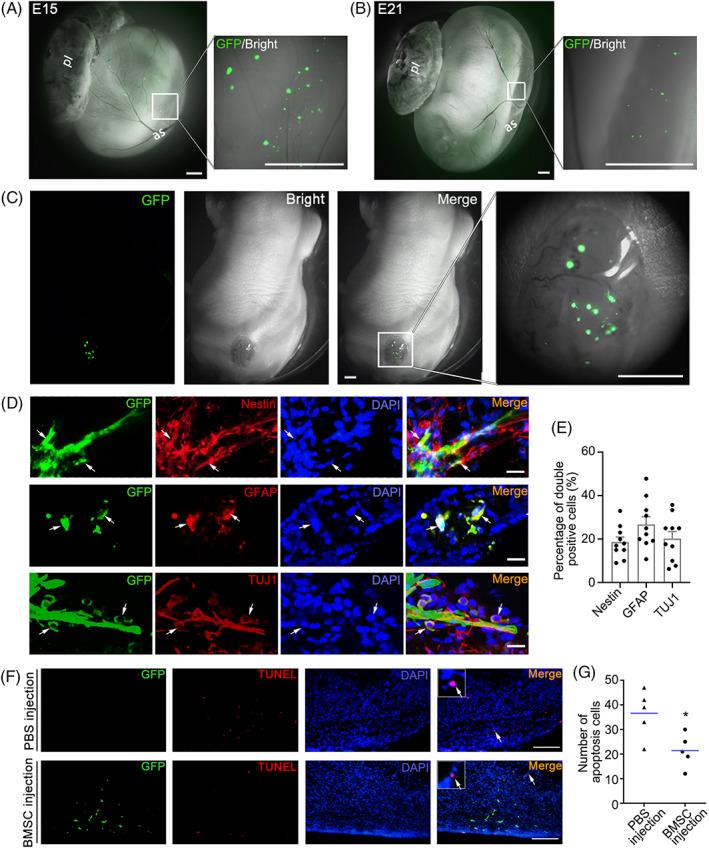 https://cdn.ncbi.nlm.nih.gov/pmc/blobs/9086/9890536/a296c075daee/CPR-56-e13354-g005.jpg