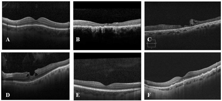 https://cdn.ncbi.nlm.nih.gov/pmc/blobs/9089/11312046/1a443c0afee3/diagnostics-14-01668-g002.jpg