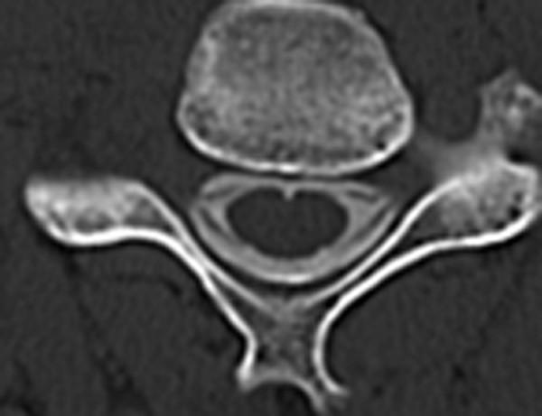 https://cdn.ncbi.nlm.nih.gov/pmc/blobs/9089/1947985/133eb3fe4b08/1749-7221-2-16-3.jpg