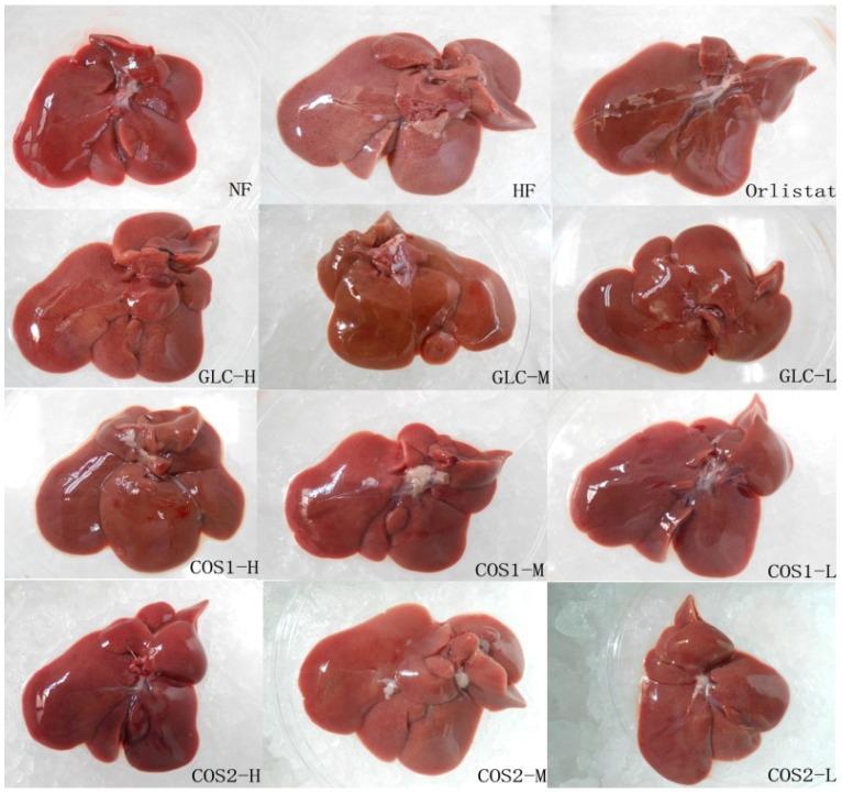 https://cdn.ncbi.nlm.nih.gov/pmc/blobs/9089/4446603/4e20498dbd72/marinedrugs-13-02732-g005.jpg