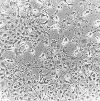 https://cdn.ncbi.nlm.nih.gov/pmc/blobs/908e/1888227/457aabee687c/amjpathol00162-0038-a.jpg