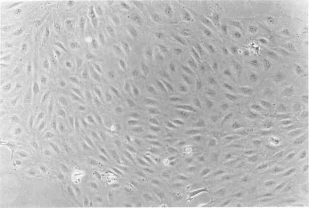 https://cdn.ncbi.nlm.nih.gov/pmc/blobs/908e/1888227/5a1579b95be8/amjpathol00162-0032-a.jpg