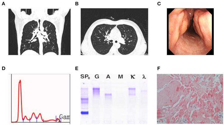 https://cdn.ncbi.nlm.nih.gov/pmc/blobs/9095/8554224/133c62a52d13/fmed-08-728561-g0001.jpg