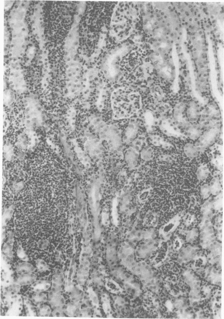 https://cdn.ncbi.nlm.nih.gov/pmc/blobs/9097/422185/a7374aca17a8/iai00203-0212-b.jpg