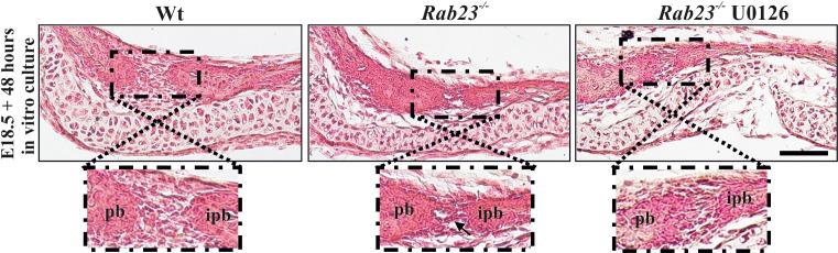 https://cdn.ncbi.nlm.nih.gov/pmc/blobs/9097/7423339/fc1918c4095d/elife-55829-fig5-figsupp1.jpg