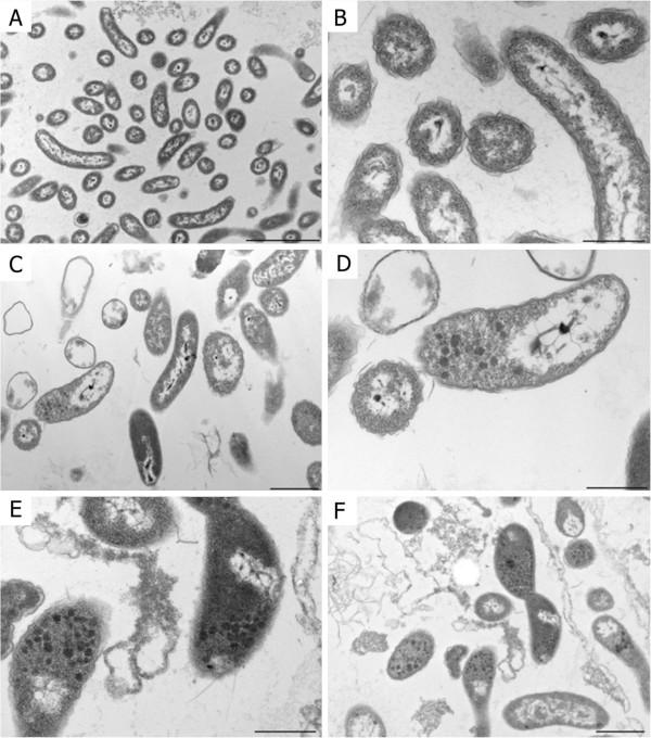 https://cdn.ncbi.nlm.nih.gov/pmc/blobs/909f/3577442/010005f47811/1471-2180-12-252-5.jpg
