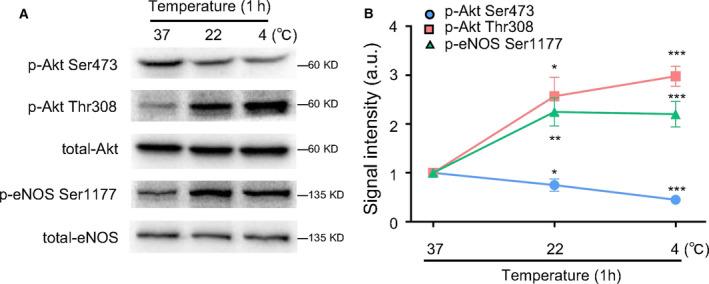 https://cdn.ncbi.nlm.nih.gov/pmc/blobs/90a1/8255840/ee17b2edd429/FEB4-11-1953-g003.jpg