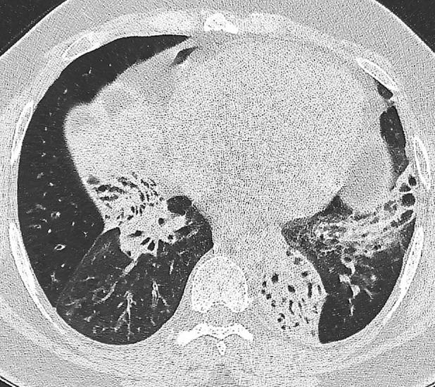 https://cdn.ncbi.nlm.nih.gov/pmc/blobs/90a9/7308669/6f34d3dc3c5a/RCR2-8-e00602-g002.jpg