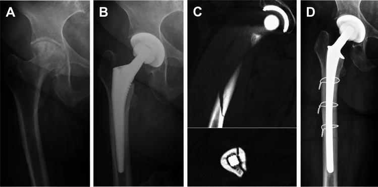 https://cdn.ncbi.nlm.nih.gov/pmc/blobs/90b5/11246254/2fa0c7eb2d47/223_2024_1237_Fig2_HTML.jpg