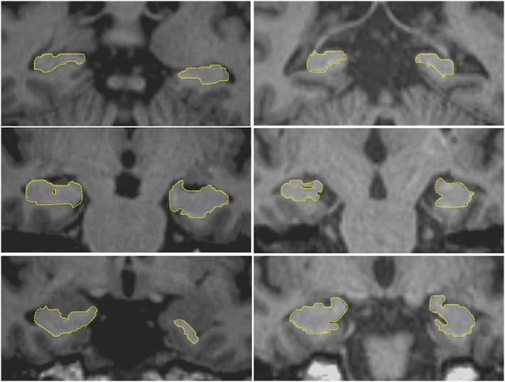 https://cdn.ncbi.nlm.nih.gov/pmc/blobs/90b6/6411582/dcf5f222aac9/gr1.jpg