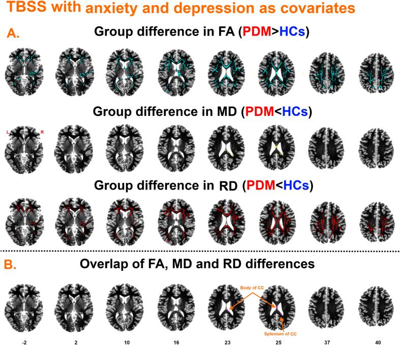 https://cdn.ncbi.nlm.nih.gov/pmc/blobs/90b9/4861968/92db85e0a1f0/srep25836-f3.jpg